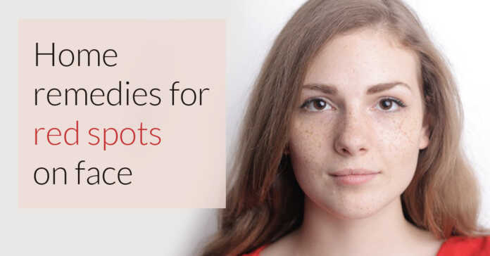 Home remedies for red spots on face