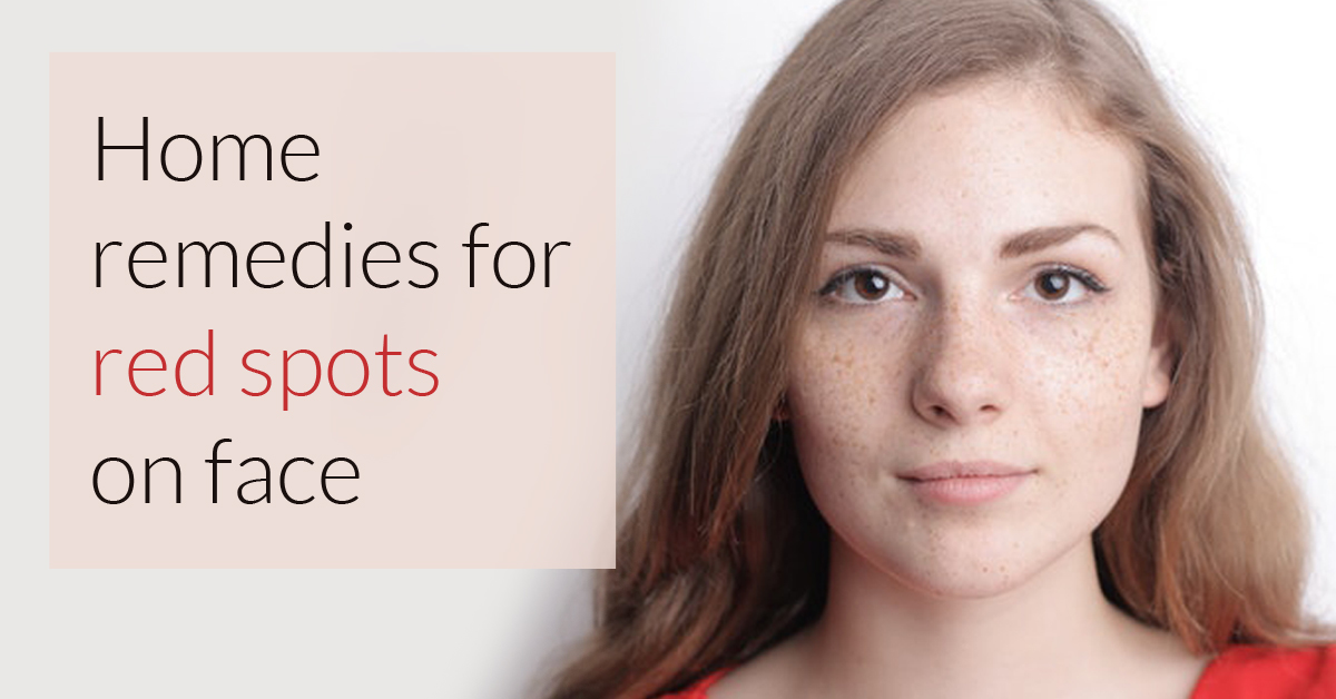 Home remedies for red spots on face